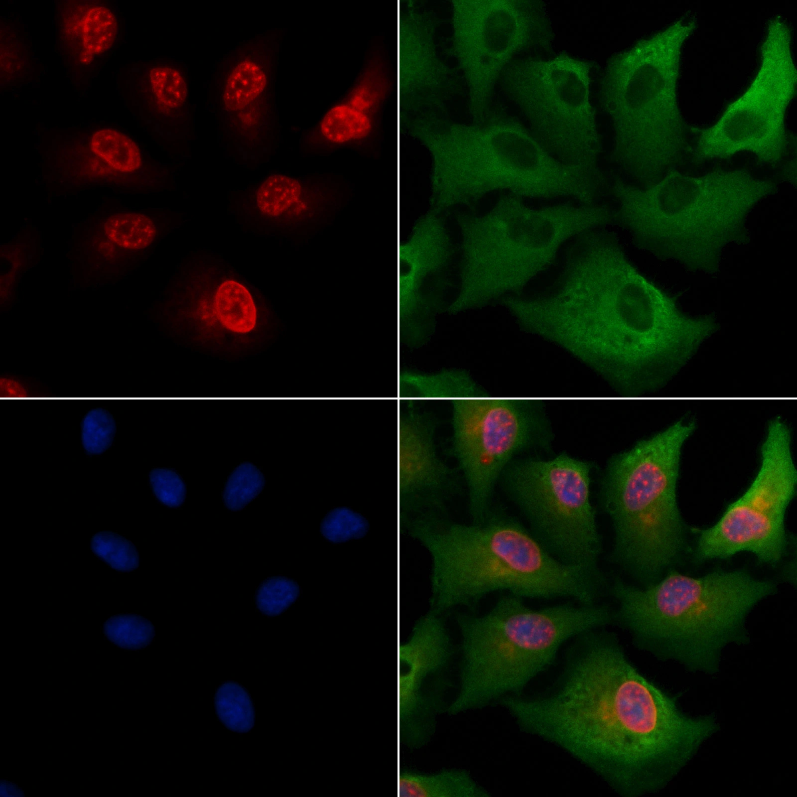 ICC/IF analysis of PFA-fixed A549 cells using GTX04347 SHARP1 antibody. Red : Primary antibody Green : Beta tubulin Blue : DAPI Permeabilization : 0.1% Triton X-100 ICC/IF analysis of PFA-fixed A549 cells using GTX04347 SHARP1 antibody. Red : Primary antibody Green : Beta tubulin Blue : DAPI Permeabilization : 0.1% Triton X-100