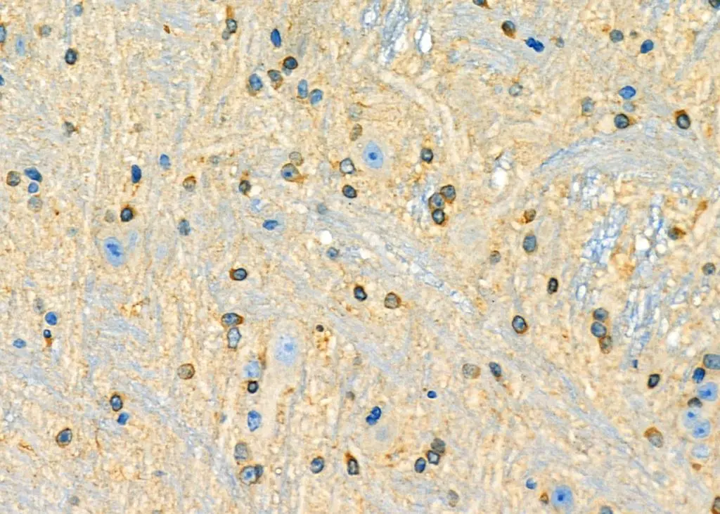 IHC-P analysis of mouse brain tissue using GTX04347 SHARP1 antibody. Antigen retrieval : Heat mediated citrate buffer Dilution : 1:100