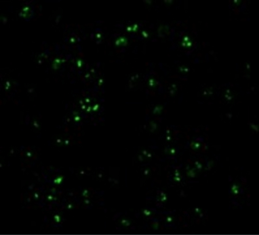 ICC/IF analysis of K562 cells using GTX04354 CARD8 antibody. Dilution : 20 microg/mL ICC/IF analysis of K562 cells using GTX04354 CARD8 antibody. Dilution : 20 microg/mL