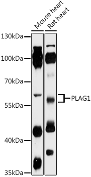 WB analysis of various sample lysates using GTX04492 PLAG1 antibody. Dilution : 1:1000 Loading : 25 microg WB analysis of various sample lysates using GTX04492 PLAG1 antibody. Dilution : 1:1000 Loading : 25 microg