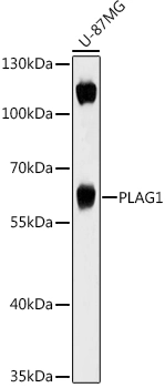 WB analysis of U-87MG whole cell lysates using GTX04492 PLAG1 antibody. Dilution : 1:1000 Loading : 25 microg