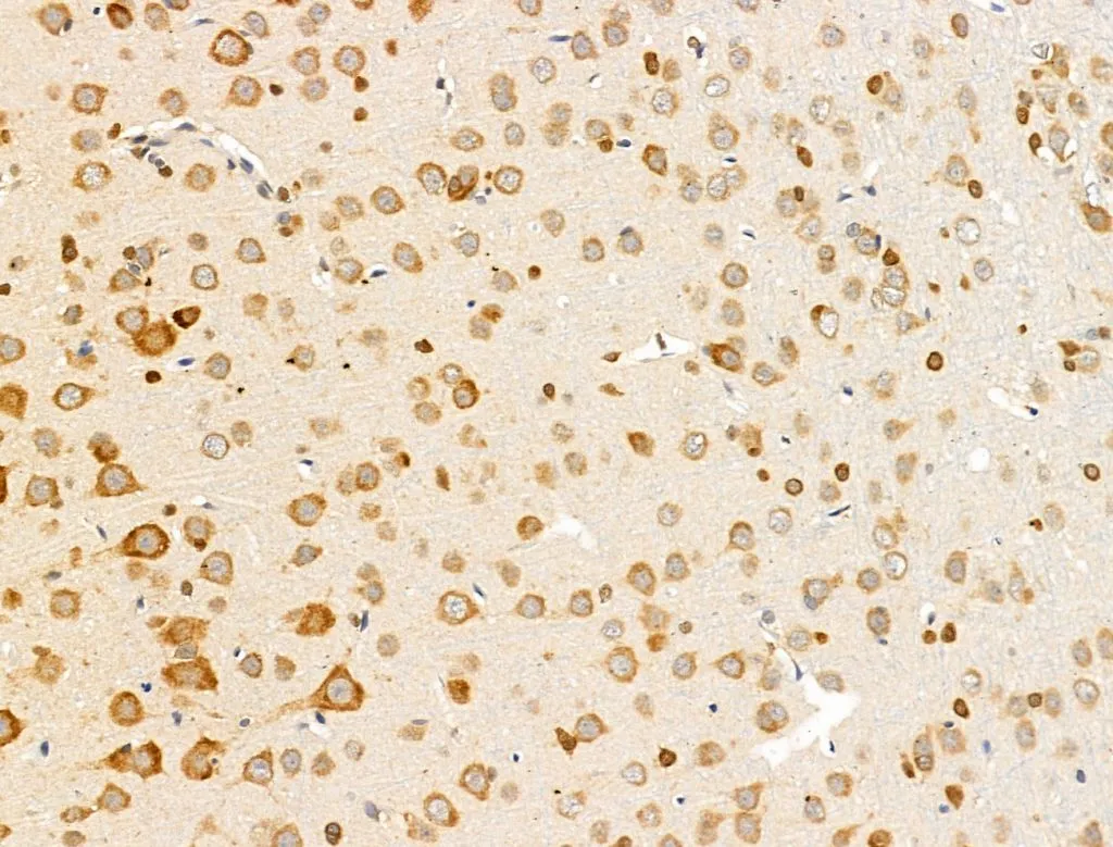 IHC-P analysis of rat brain tissue using GTX0493 OMP antibody. Antigen retrieval : Heat mediated citrate buffer. Dilution : 1:100 IHC-P analysis of rat brain tissue using GTX0493 OMP antibody. Antigen retrieval : Heat mediated citrate buffer. Dilution : 1:100