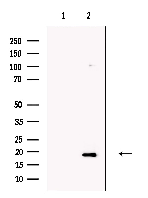 WB analysis of HepG2 whole cell lysates using GTX0493 OMP antibody. The lane on the left was treated with blocking peptide.