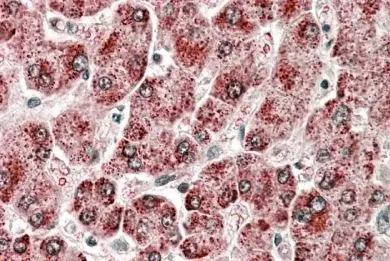IHC-P analysis of human liver tissue using GTX04495 CYP2E1 antibody. Antigen retrieval : Steamed antigen retrieval with citrate buffer (pH 6) Dilution : 3.8 microg/ml IHC-P analysis of human liver tissue using GTX04495 CYP2E1 antibody. Antigen retrieval : Steamed antigen retrieval with citrate buffer (pH 6) Dilution : 3.8 microg/ml