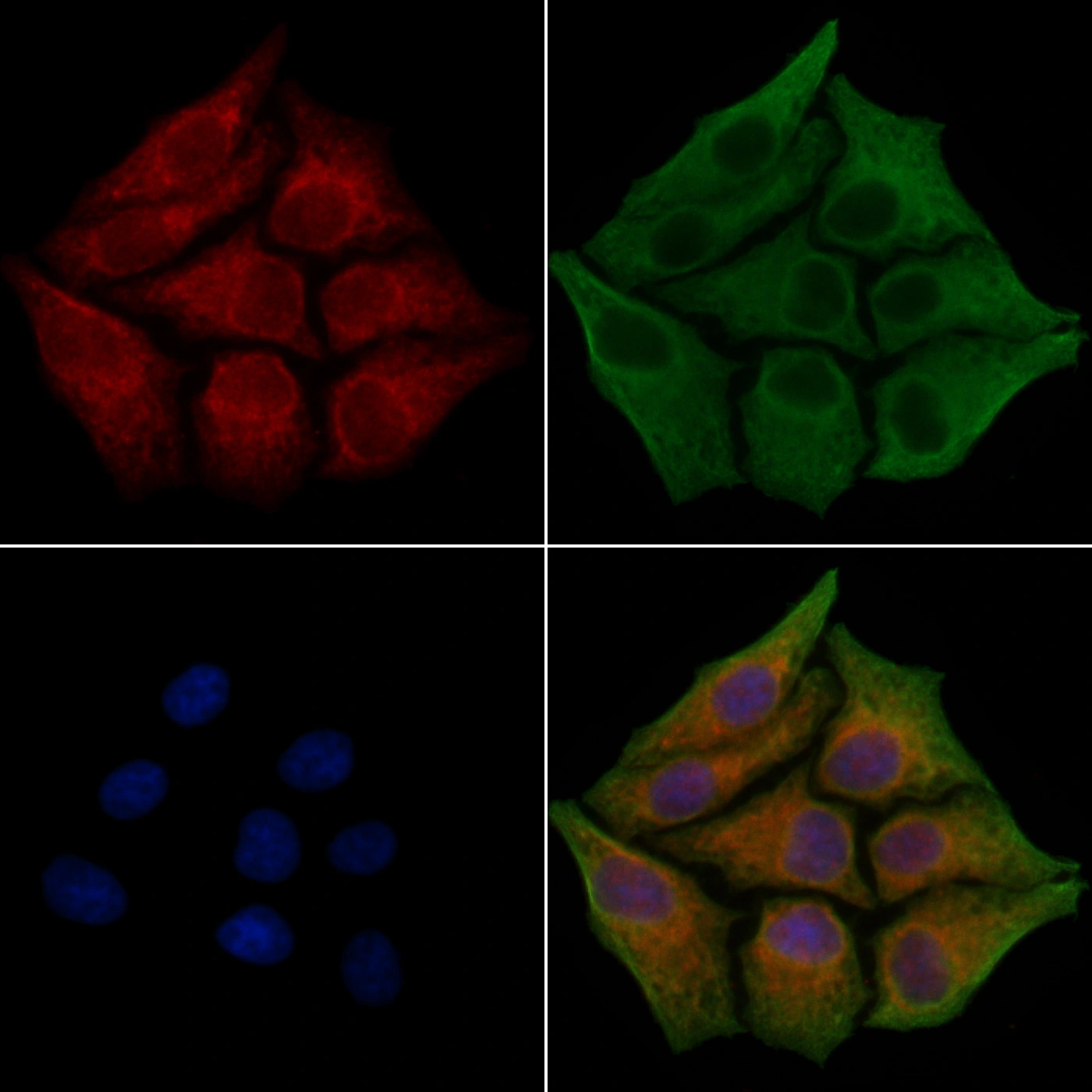 ICC/IF analysis of PFA fixed HepG2 cells with Forskolin treatment (4microM, 30min) using GTX04498 Fibronectin antibody. Red : Primary antibody Green : Beta tubulin Blue : DAPI Permeabilization : 0.1% Triton X-100 ICC/IF analysis of PFA fixed HepG2 cells with Forskolin treatment (4microM, 30min) using GTX04498 Fibronectin antibody. Red : Primary antibody Green : Beta tubulin Blue : DAPI Permeabilization : 0.1% Triton X-100