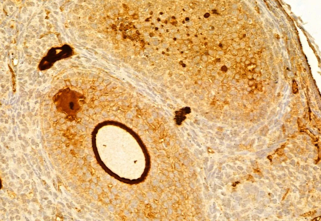 IHC-P analysis of mouse ovary tissue using GTX04498 Fibronectin antibody. Antigen retrieval : Heat mediated citrate buffer Dilution : 1:100