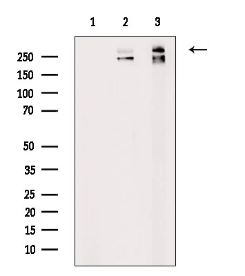 WB analysis of various sample lysates using GTX04498 Fibronectin antibody. Lane 1 : MDA whole cell lysates with blocking peptide treatment Lane 2 : MDA whole cell lysates Lane 3 : EC-304 whole cell lysates