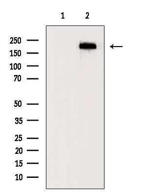 WB analysis of PC12 whole cell lysates using GTX04498 Fibronectin antibody. The lane on the left was treated with blocking peptide.