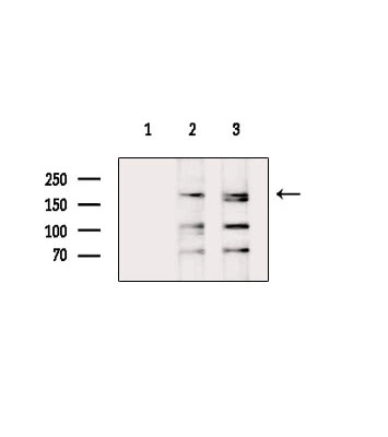 WB analysis of various sample lysates using GTX04498 Fibronectin antibody. Lane 1 : Serum starvated HepG2 whole cell lysates with blocking peptide treatment Lane 2 : Serum starvated HepG2 whole cell lysates Lane 3 : HeLa whole cell lysates with LPS treatment (4hr)
