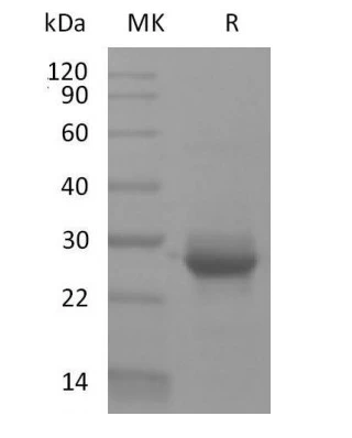 SDS-PAGE analysis of GTX04508-pro Human K-Ras (G12V mutant) protein, His tag under reducing conditions. SDS-PAGE analysis of GTX04508-pro Human K-Ras (G12V mutant) protein, His tag under reducing conditions.