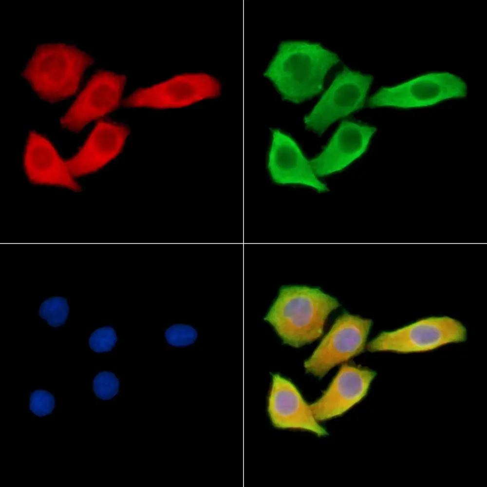 ICC/IF analysis of PFA fixed HeLa cells using GTX04514 MAP1A antibody. Red : Primary antibody Green : Beta tubulin Blue : DAPI ICC/IF analysis of PFA fixed HeLa cells using GTX04514 MAP1A antibody. Red : Primary antibody Green : Beta tubulin Blue : DAPI