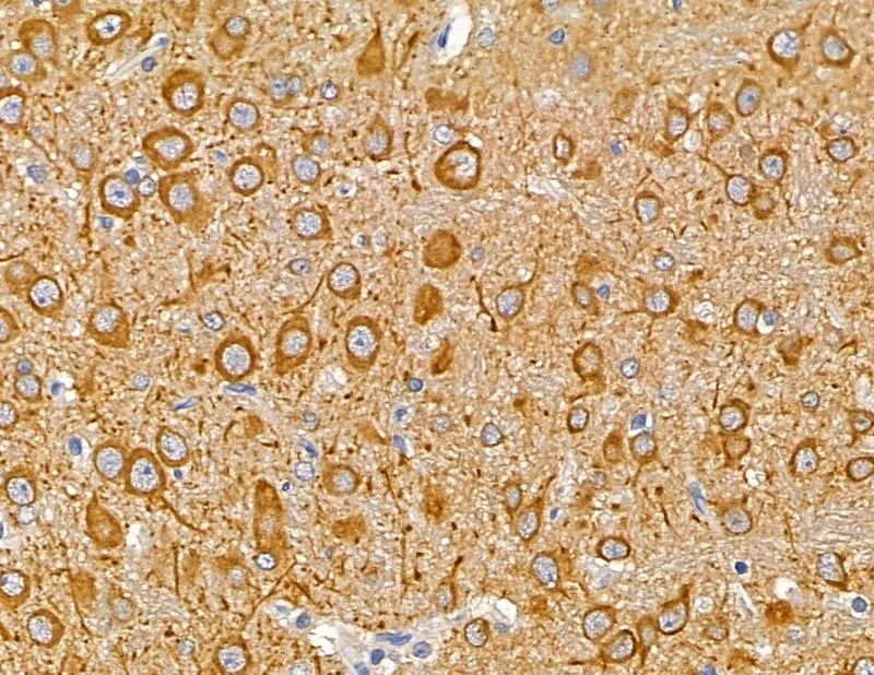 IHC-P analysis of rat brain tissue using GTX04514 MAP1A antibody. Antigen retrieval : Heat mediated citrate buffer Dilution : 1:100