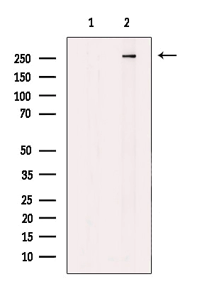 WB analysis of COLO205 whole cell lysates using GTX04514 MAP1A antibody. The lane on the left was treated with blocking peptide.