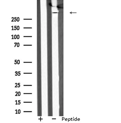 WB analysis of COLO205 whole cell lysates using GTX04514 MAP1A antibody. The lane on the left was treated with blocking peptide.