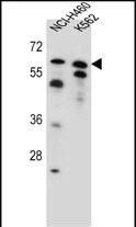 WB analysis of various cell lysates using GTX04521 PLAG1 antibody. Loading : 35 microg WB analysis of various cell lysates using GTX04521 PLAG1 antibody. Loading : 35 microg