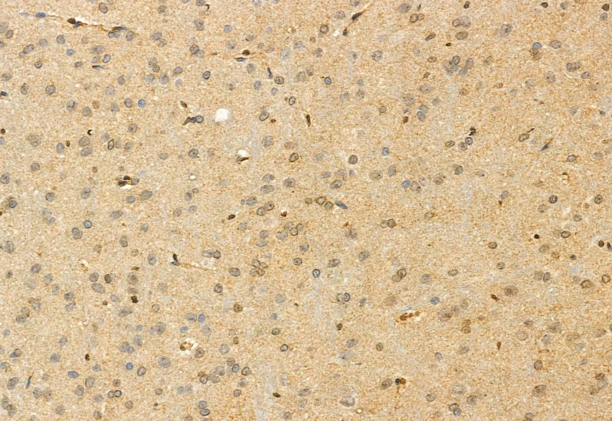 IHC-P analysis of rat brain tissue using GTX04534 FAM38A antibody. Antigen retrieval : Heat mediated citrate buffer Dilution : 1:100