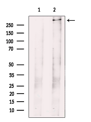 WB analysis of rat brain tissue lysates using GTX04534 FAM38A antibody. The lane on the left was treated with blocking peptide.
