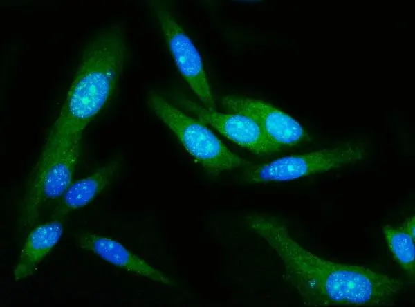 ICC/IF analysis of PC-3 cells using GTX04538 Gasdermin D antibody [6D11]. Antigen retrieval : IHC enzyme antigen retrieval reagent Green : Primary antibody Blue : DAPI Dilution : 5 microg/mL