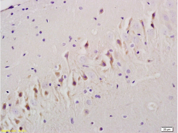 IHC-P analysis of rat brain tissue using GTX04547 TGF beta Receptor I antibody. Dilution : 1:200 IHC-P analysis of rat brain tissue using GTX04547 TGF beta Receptor I antibody. Dilution : 1:200