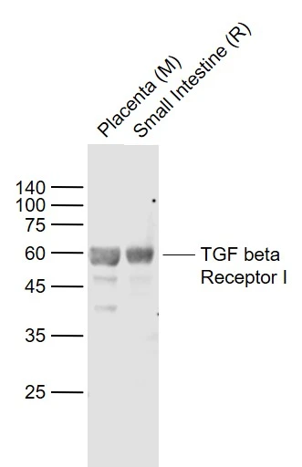 WB analysis of various tissue lysates using GTX04547 TGF beta Receptor I antibody. Lane1 : Mouse placenta tissue lysate Lane2 : Rat small intestine tissue lysate Dilution : 1:1000
