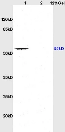 WB analysis of various tissue lysates using GTX04547 TGF beta Receptor I antibody. Lane1 : Rat brain tissue lysate Lane2 : Mouse embryo tissue lysate Dilution : 1:200