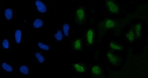 ICC/IF analysis of HeLa cells using GTX04548 GLIS1 antibody. Green : Primary antibody Blue : DAPI Antigen retrieval : IHC enzyme antigen retrieval reagent Dilution : 5 microg/mL