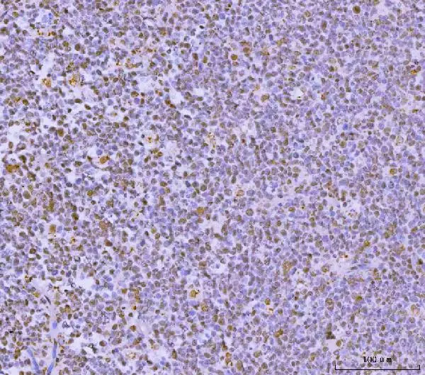 IHC-P analysis of human tonsil tissue using GTX04548 GLIS1 antibody. Antigen retrieval : Heat mediated EDTA buffer (pH8.0) Dilution : 2 microg/mL