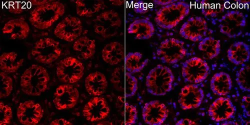 IHC-P analysis of human colon tissue using GTX04562 Cytokeratin 20 antibody. Orange : Primary antibody Blue : DAPI Dilution : 1:100