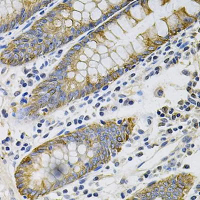 IHC-P analysis of human colon tissue using GTX04562 Cytokeratin 20 antibody. Antigen retrieval : Heat mediated with 10 mM PBS buffer pH 7.2 Dilution : 1:100