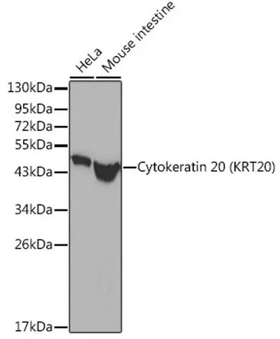 WB analysis of various samples using GTX04562 Cytokeratin 20 antibody. Lane 1 : HeLa whole cell lysate Lane 2 : mouse intestine tissue lysate Loading : 25microg
