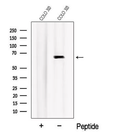 WB analysis of COLO 320 whole cell lysate using GTX04568 Nurr1 antibody. The lane on the left was treated with blocking peptide. WB analysis of COLO 320 whole cell lysate using GTX04568 Nurr1 antibody. The lane on the left was treated with blocking peptide.