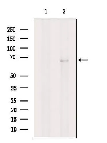 WB analysis of HeLa whole cell lysate using GTX04568 Nurr1 antibody. The lane on the left was treated with blocking peptide.