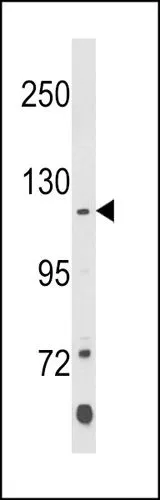 WB analysis of K562 whole cell lysate using GTX04569 Klotho antibody. Loading : 35 microg