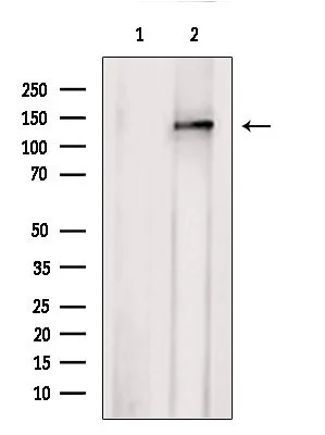 WB analysis of MCF-7 whole cell lysate using GTX04581 AHI1 antibody. The lane on the left was treated with blocking peptide. WB analysis of MCF-7 whole cell lysate using GTX04581 AHI1 antibody. The lane on the left was treated with blocking peptide.