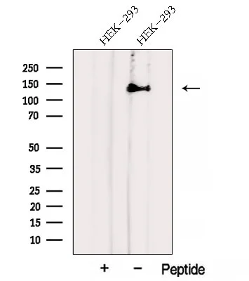 WB analysis of HEK293 whole cell lysate using GTX04581 AHI1 antibody. The lane on the left was treated with blocking peptide.