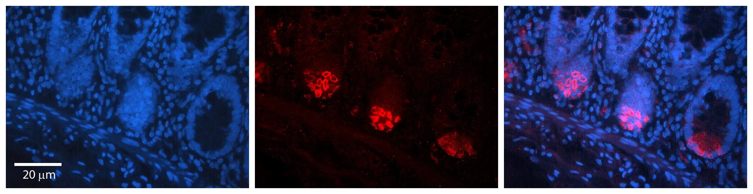 IHC-P analysis of human colon tissue using GTX04582 TMEM26 antibody. Red : Primary antibody Blue : Nucleus Dilution : 1:100 IHC-P analysis of human colon tissue using GTX04582 TMEM26 antibody. Red : Primary antibody Blue : Nucleus Dilution : 1:100