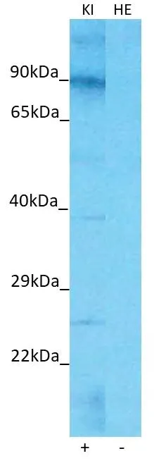 WB analysis of various samples using GTX04582 TMEM26 antibody. KI : Human Kidney tissue lysate, a Positive control HE : Human Fetal Heart tissue lysate, a Negative control Loading : 25 microg Dilution : 1 microg/mL