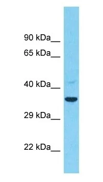 WB analysis of COLO205 whole cell lysate using GTX04582 TMEM26 antibody. Dilution : 1 microg/mL