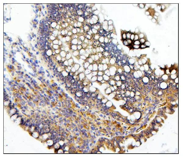 IHC-P analysis of rat intestine tissue using GTX04584 CDC42 antibody. Antigen retrieval : Heat mediated EDTA buffer (pH 8.0) Dilution : 1 microg/mL