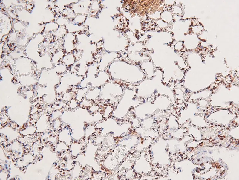 IHC-P analysis of rat lung tissue using GTX04588 GCN2 (phospho Thr899) antibody. Antigen retrieval : Heat mediated citrate buffer Dilution : 1:200