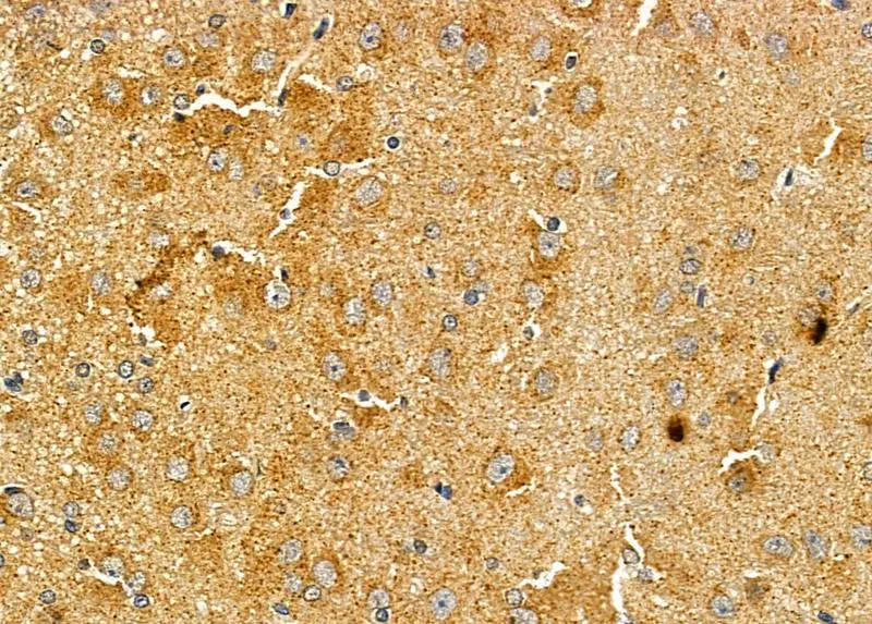 IHC-P analysis of rat brain tissue using GTX04589 ASAP1 antibody. Antigen retrieval : Heat mediated citrate buffer Dilution : 1:100