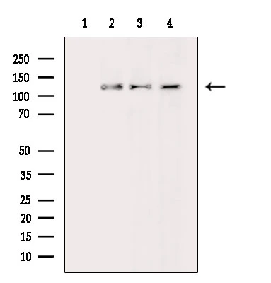 WB analysis of various samples using GTX04589 ASAP1 antibody. Lane 1 : Mouse brain tissue lysate blocked with antigen-specific peptides Lane 2 : Mouse brain tissue lysate Lane 3 : 3T3 cells with LPS treatment Raw264.7 cells with H?O? treatment