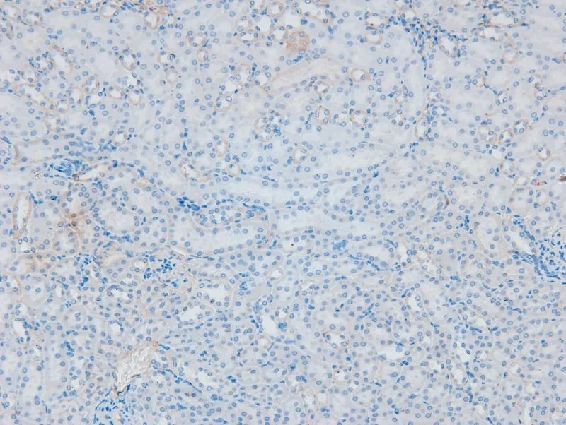 IHC-P analysis of mouse kidney tissue using GTX04593 PKC beta 1 (phospho Ser661) antibody. Antigen retrieval : Heat mediated citrate buffer. Dilution : 1:200