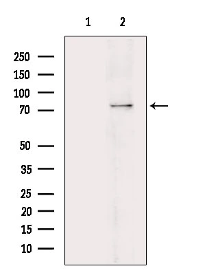 WB analysis of Raw264.7 whole cell lysate with LPS-treatment using GTX04593 PKC beta 1 (phospho Ser661) antibody. The lane on the left was treated with blocking peptide.