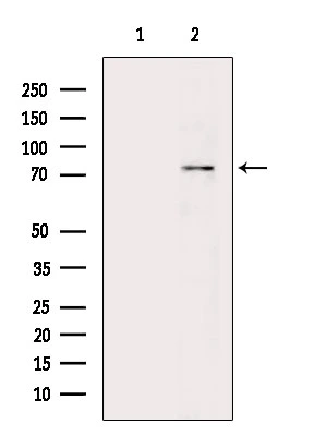 WB analysis of mouse brain tissue lysate using GTX04593 PKC beta 1 (phospho Ser661) antibody. The lane on the left was treated with blocking peptide.