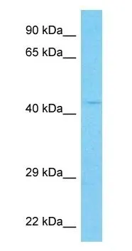 WB analysis of Jurkat whole cell lysats using GTX04598 LIPT1 antibody. Dilution : 1 microg/mL WB analysis of Jurkat whole cell lysats using GTX04598 LIPT1 antibody. Dilution : 1 microg/mL