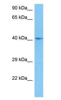 WB analysis of PC-3 whole cell lysate using GTX04608 YKL-39 antibody. Dilution : 1 microg/mL WB analysis of PC-3 whole cell lysate using GTX04608 YKL-39 antibody. Dilution : 1 microg/mL