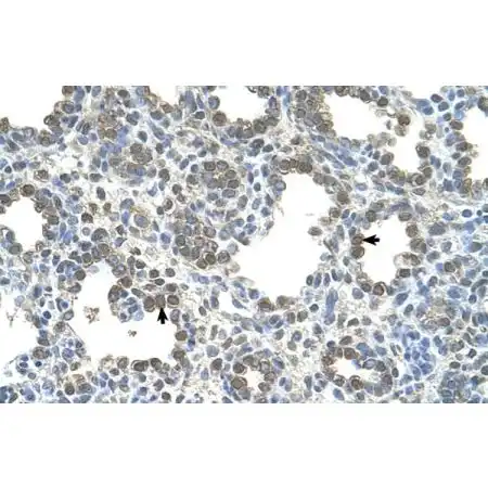 IHC-P analysis of human lung tissue using GTX04614 SLC26A5 antibody. IHC-P analysis of human lung tissue using GTX04614 SLC26A5 antibody.