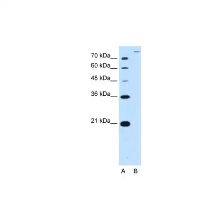 WB analysis of HepG2 whole cell lysate using GTX04614 SLC26A5 antibody. Dilution : 2.5 microg/mL