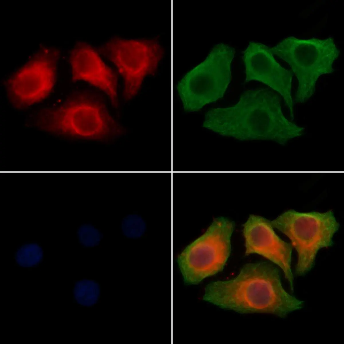 ICC/IF analysis of PFA-fixed HeLa cells using GTX04615 SLC25A5 antibody. Red : Primary antibody Green : Beta tubulin Blue : DAPI Permeabilization : 0.1% Triton X-100 ICC/IF analysis of PFA-fixed HeLa cells using GTX04615 SLC25A5 antibody. Red : Primary antibody Green : Beta tubulin Blue : DAPI Permeabilization : 0.1% Triton X-100